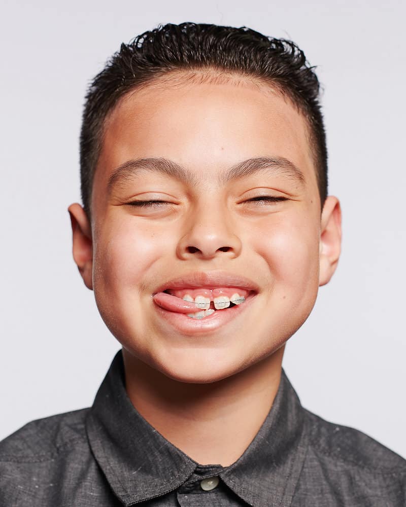 Unlocking Complex Smiles Through Multidisciplinary Dental Treatment in Charlottesville VA — orthodontic guidance from Dr. Suzanne Dennis
