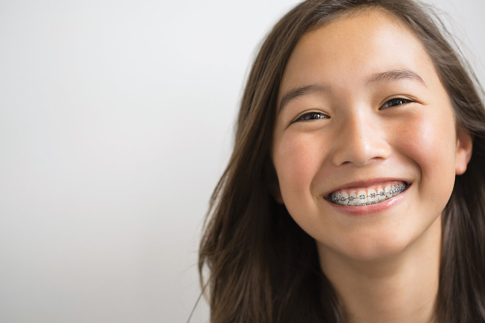 The Benefits of Two-Phase Orthodontic Treatment for Your Child's Smile — orthodontic guidance from Dr. Suzanne Dennis