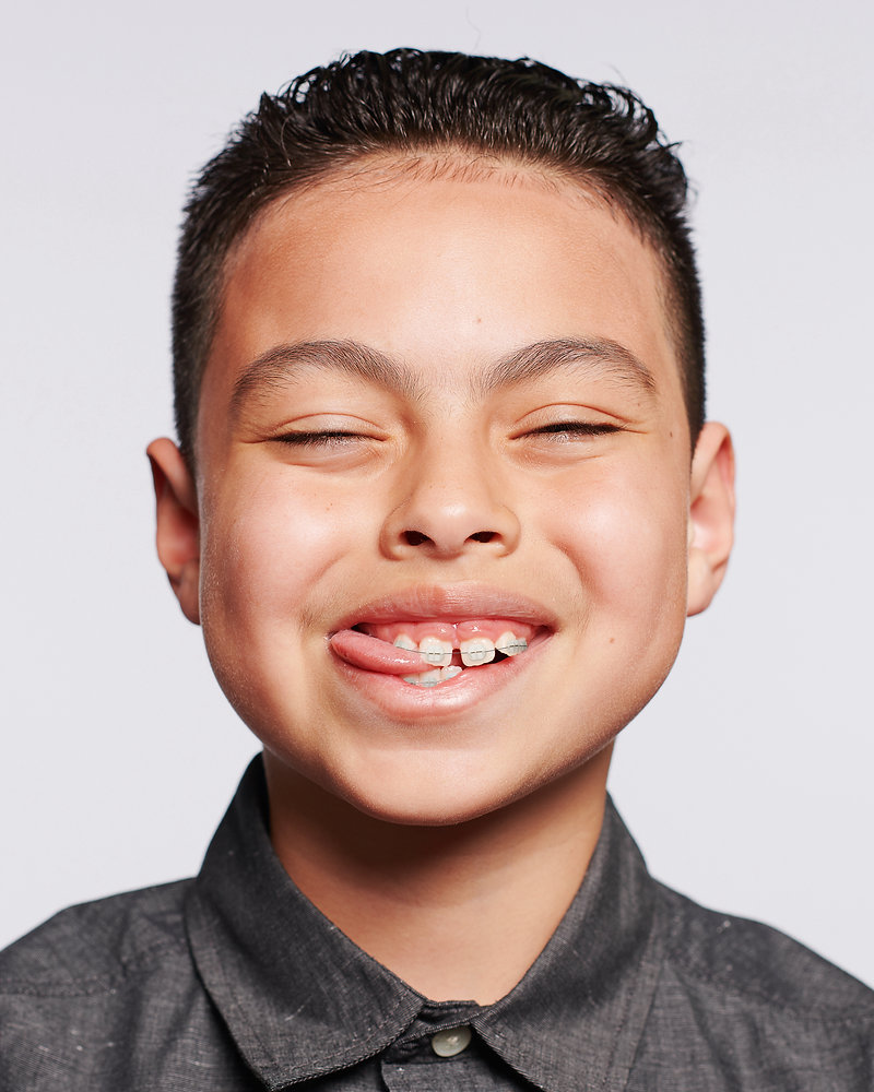 Unlocking Complex Smiles Through Multidisciplinary Dental Treatment in Charlottesville VA — orthodontic guidance from Dr. Suzanne Dennis