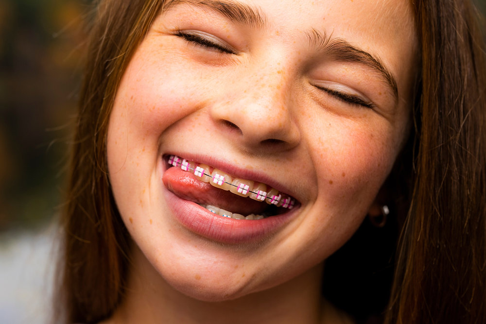 Your Tongue Is Stronger Than You Think — And Your Teeth Know It — orthodontic guidance from Dr. Suzanne Dennis